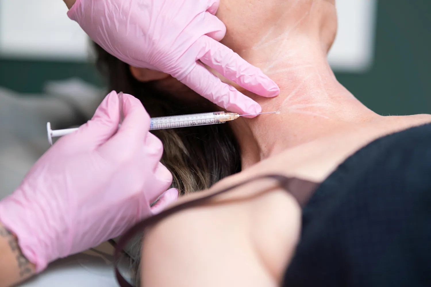 Profile balancing injectable treatment along the jawline