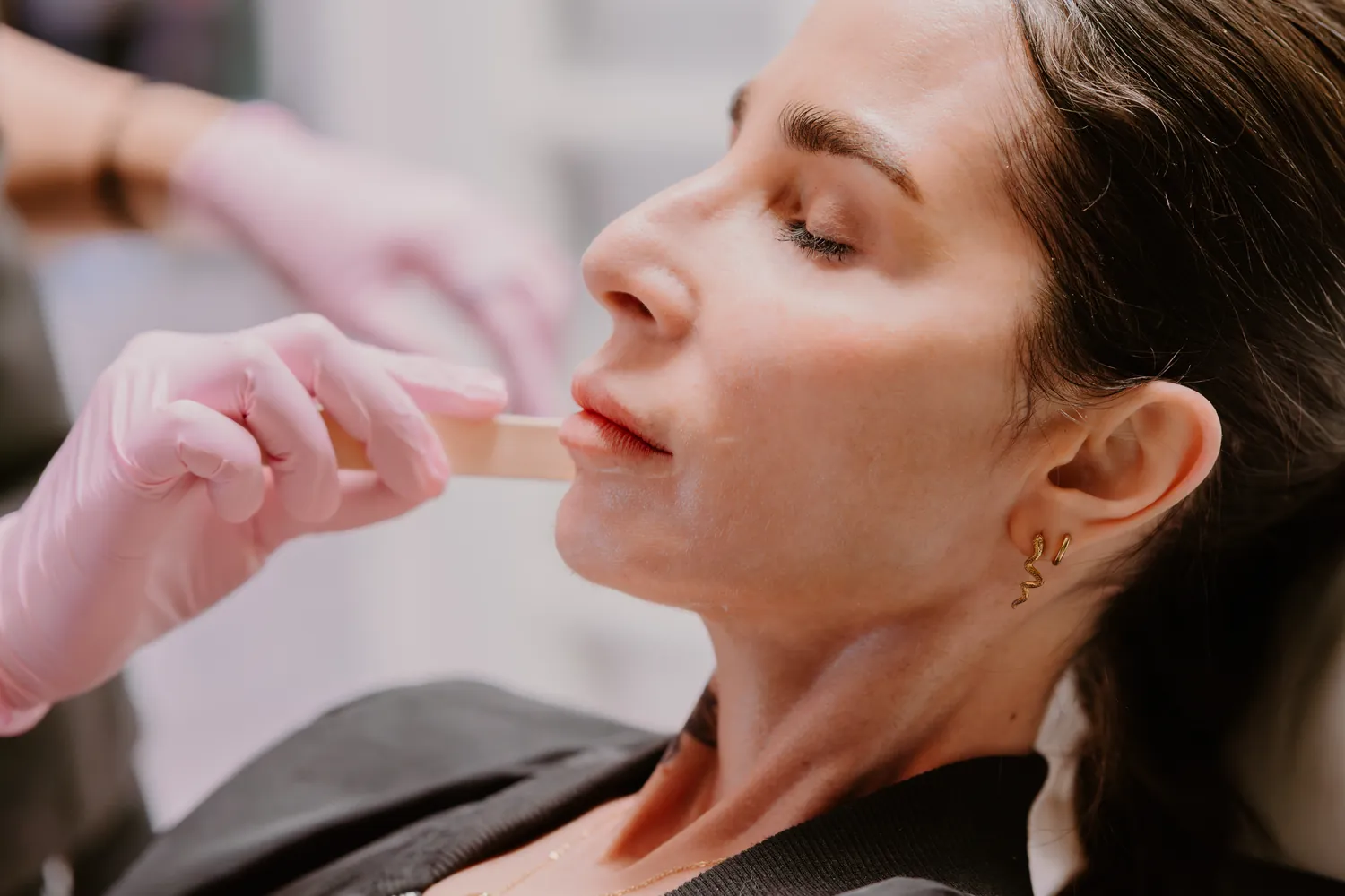 Lip enhancement treatment close-up